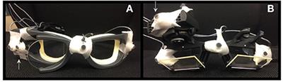 vHIT Testing of Vertical Semicircular Canals With Goggles Yield Different Results Depending on Which Canal Plane Being Tested